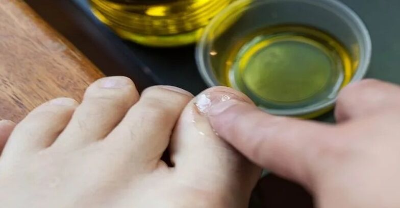 Oli essenziali per combattere i funghi