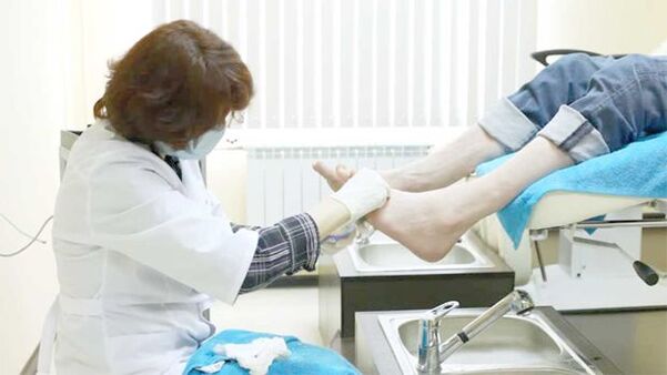 Un dermatologo tratta il fungo dell'unghia del piede