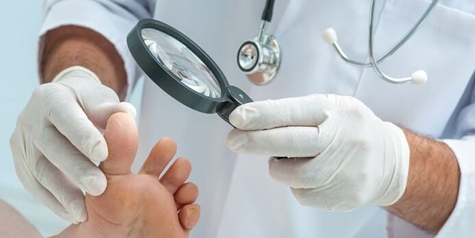 Il medico ha esaminato il piede infetto da un fungo